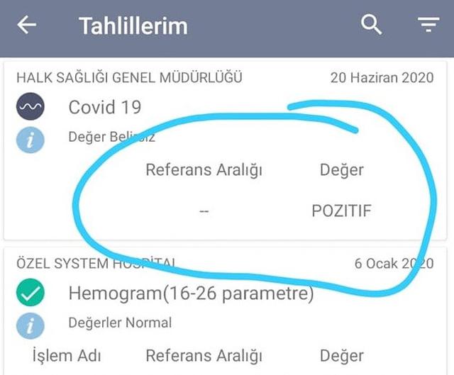 covid-19-testi-musbet-cixan-gencden-teqdirelayiq-addim