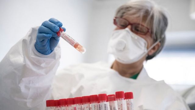bakida-koronavirus-en-cox-bu-rayonda-yayilib