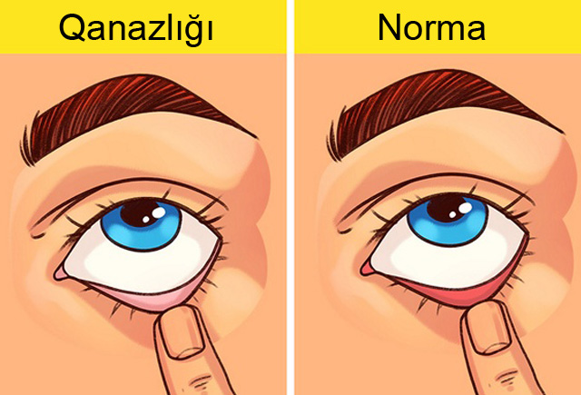qanazligini-teyin-eden-en-sade-test