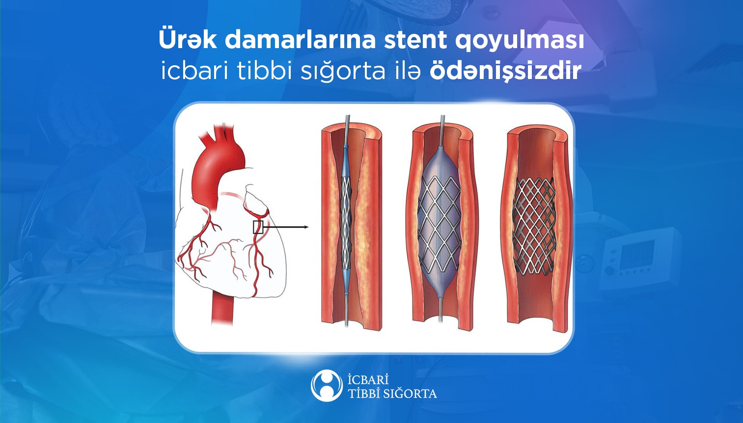icbari-tibbi-sigortaya-bu-emeliyyat-da-daxil-edildi