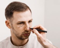 kimler-rinoplastika-emeliyyati-etdire-biler